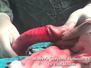 2- Shaeer's Corporal Rotation - Exposure