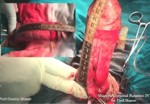 Shaeer’s Corporal Rotation - Before and After 2